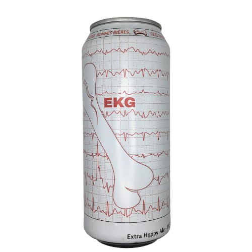 EKG
